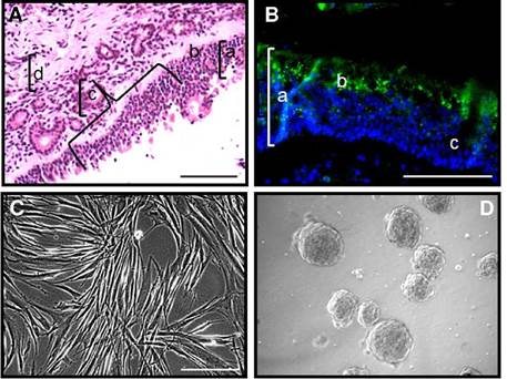 Human olfactory mesenchymal stromal cells co-expressing horizontal ...