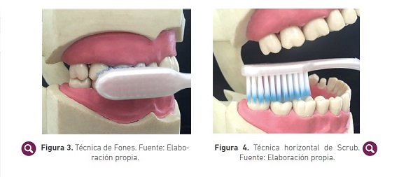 Clínica Fernández Abarca  Tipos de cepillos de dientes: ¿cuál es el más  adecuado?