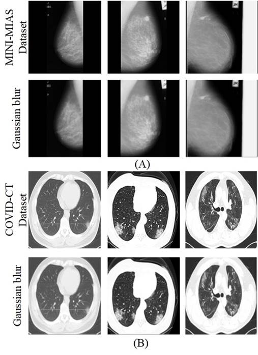 An approach to edge detection in medical imaging through histogram ...