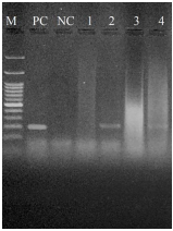 Detection of Mycoplasma capricolum subsp. capripneumoniae and ...