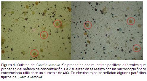 Co je giardia, Giardiaza la om