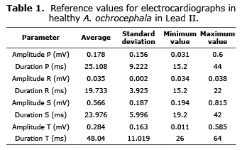 Normal Ecg Values Chart In Ms