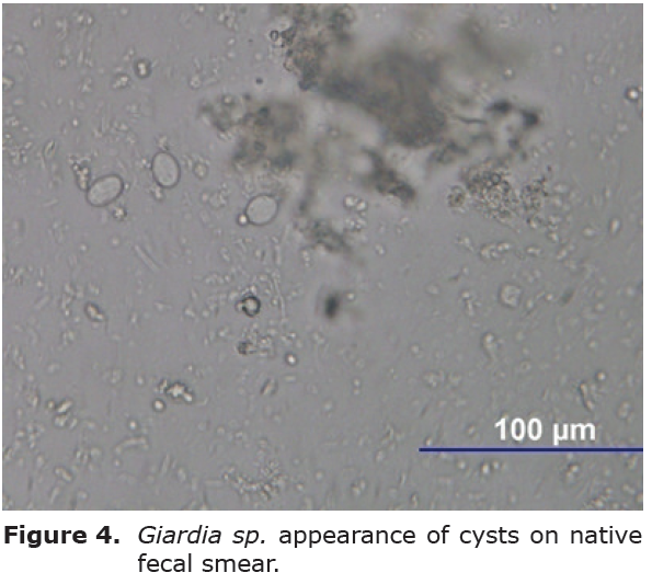 giardia high white blood cell count)