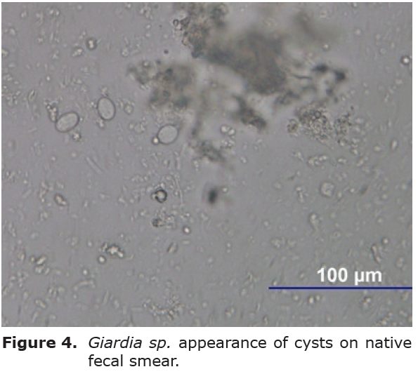 giardia high white blood cell count