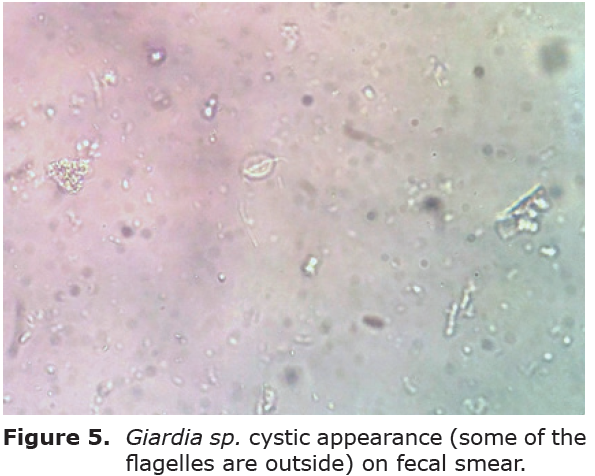 giardia duodenalis terapia