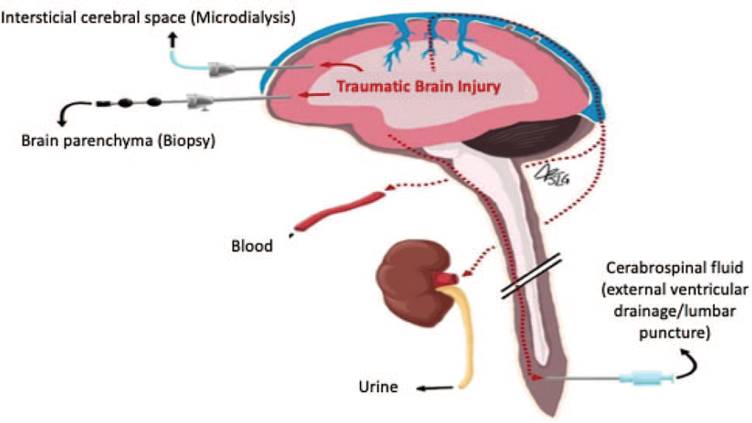 Utility of biomarkers in traumatic brain injury: a narrative review
