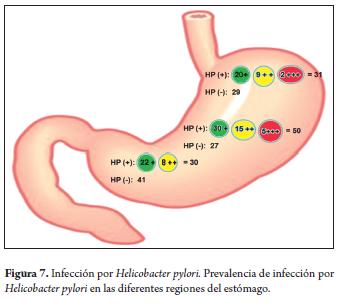 What bacteria is associated with gastritis in the abdominal antrum?