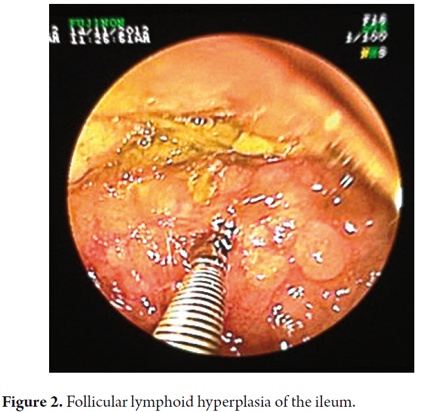 double balloon endoscopy pdf free