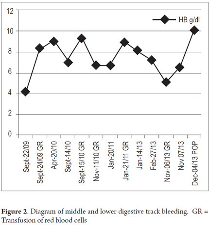 Ectopic Varices In The Proximal Jejunum Associated With Recurrent Bleeding In A Patient Without Cirrhosis Of The Liver