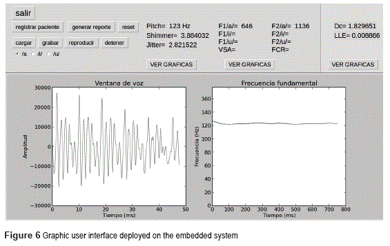 Jitter and shimmer in speech or in writing