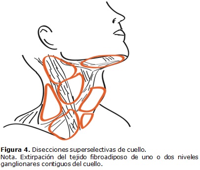 Inspección rotación carpintero Disección superselectiva de cuello: realidad evidente