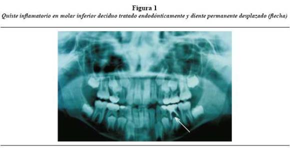 radiologia dental haring jansen pdf 89