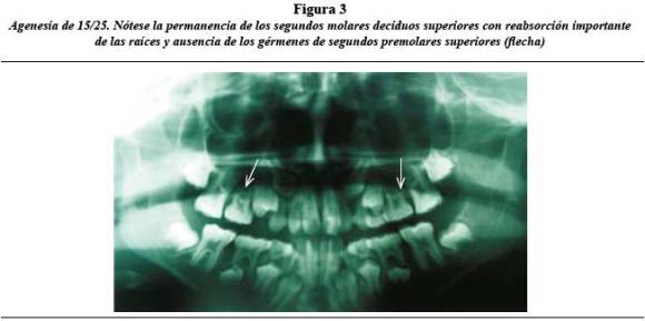 radiologia dental haring jansen pdf 89