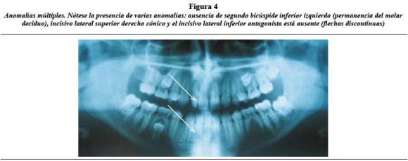 radiologia dental haring jansen pdf 31