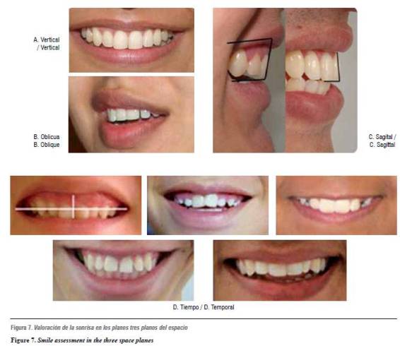 width of human teeth