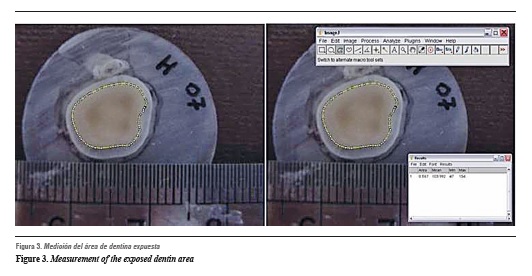 solution store extracted teeth