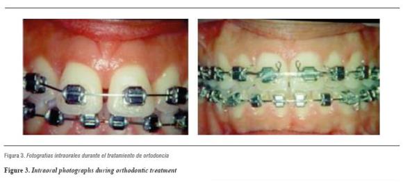 Secuencia de tratamiento de Ortodoncia